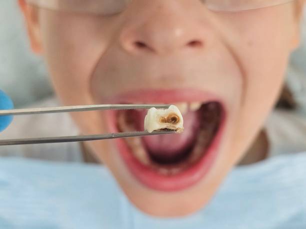 Urgent Tooth Repair in ND